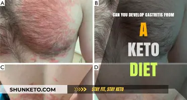 Keto Diet and Gastritis: Unraveling the Potential Connection and Risks