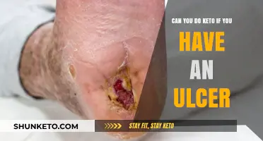 Keto and Ulcers: Safe Dieting Tips for Stomach Health