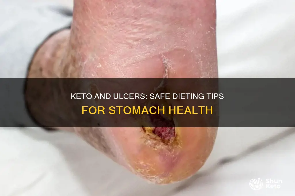 can you do keto if you have an ulcer