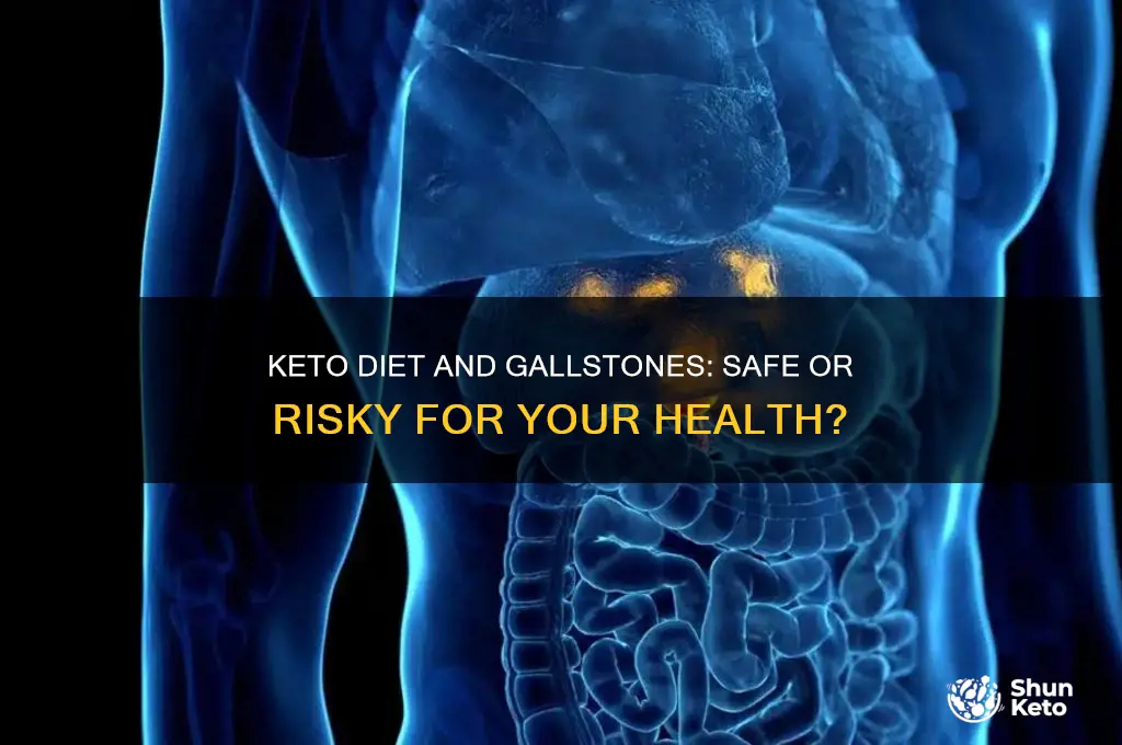 can you follow keto diet if you have gaul stones
