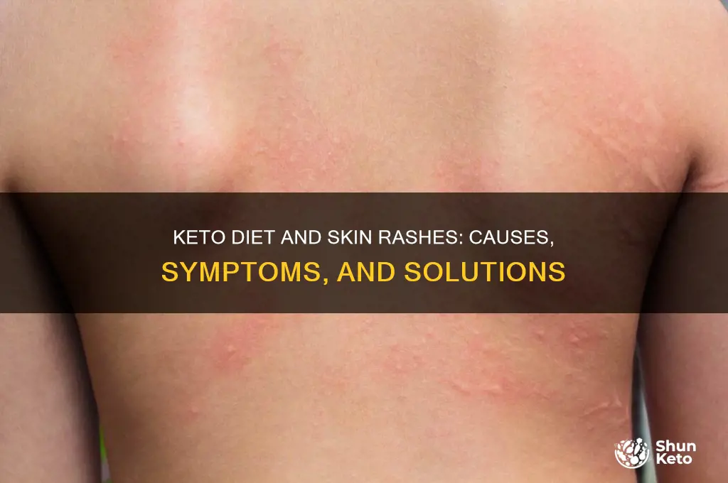 can you get a rash from keto diet