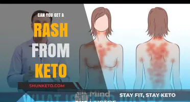 Keto Rash: Causes, Symptoms, and How to Prevent It