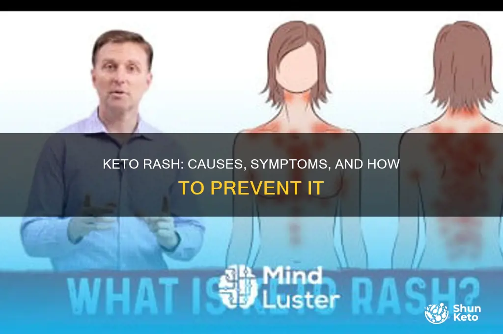 can you get a rash from keto