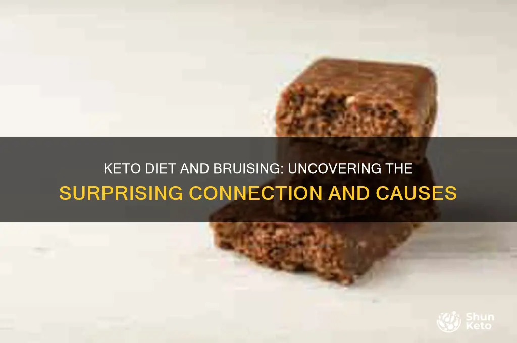 can you get lots of bruising from keto diet