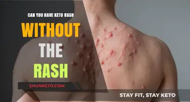 Keto Rash Without Visible Symptoms: Is It Possible?