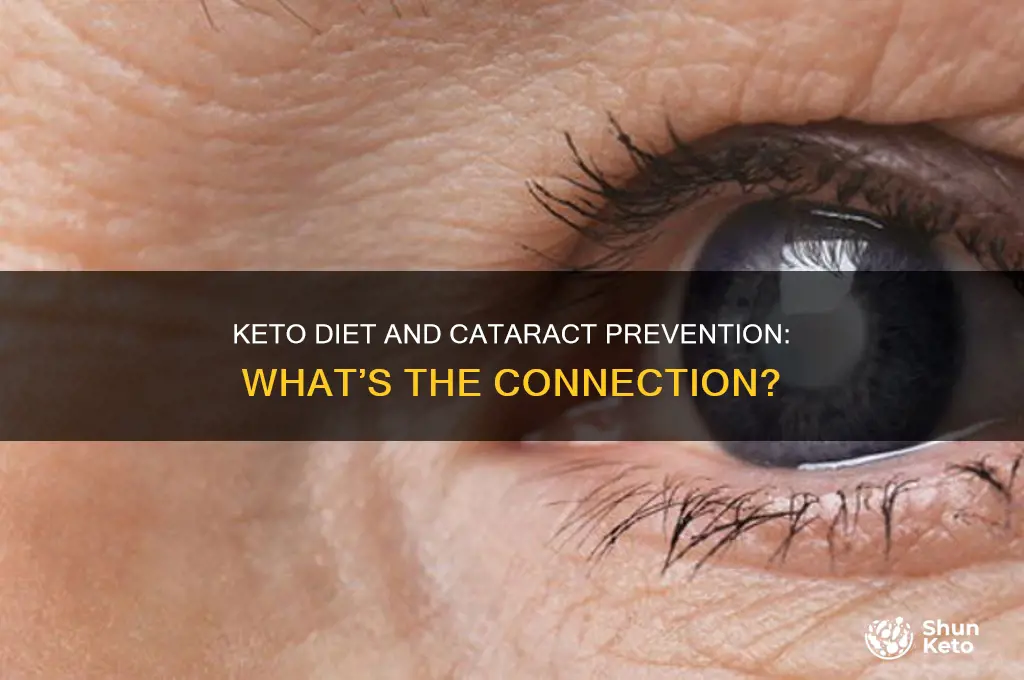 can you prevent cataracts with keto