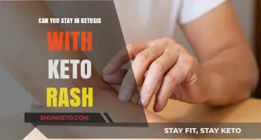 Keto Rash and Ketosis: Can You Maintain Both Simultaneously?