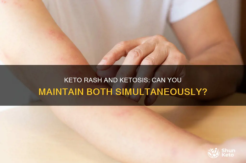 can you stay in ketosis with keto rash