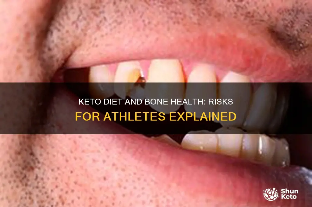 could a keto diet be bad for athletes bones