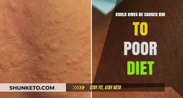 How Diet Influences Hives and Skin Health
