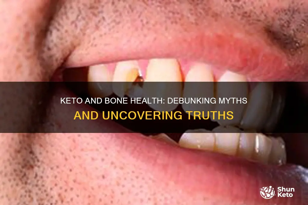 could keto be bones