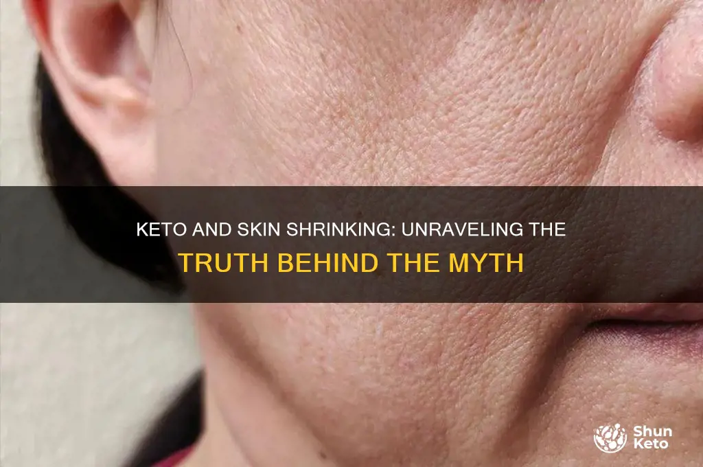did your skin shrink with you on keto