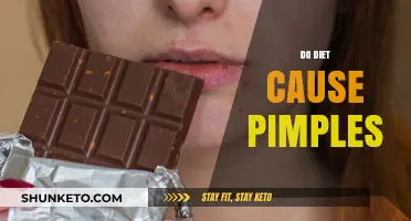 Diet's Dark Side: Pimples and Food