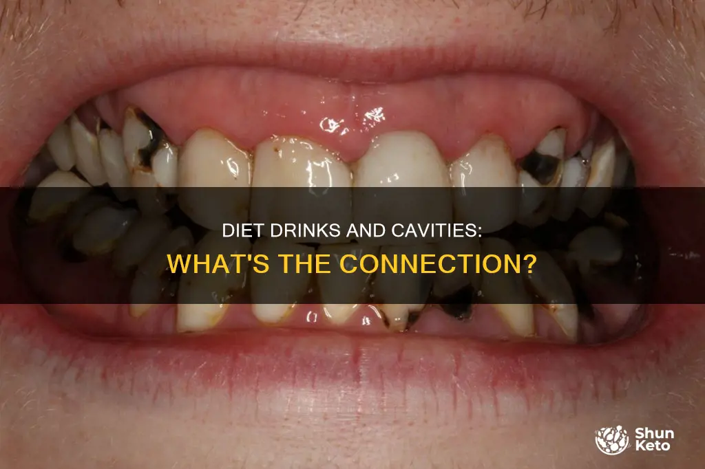 do diet drinks cause cavities