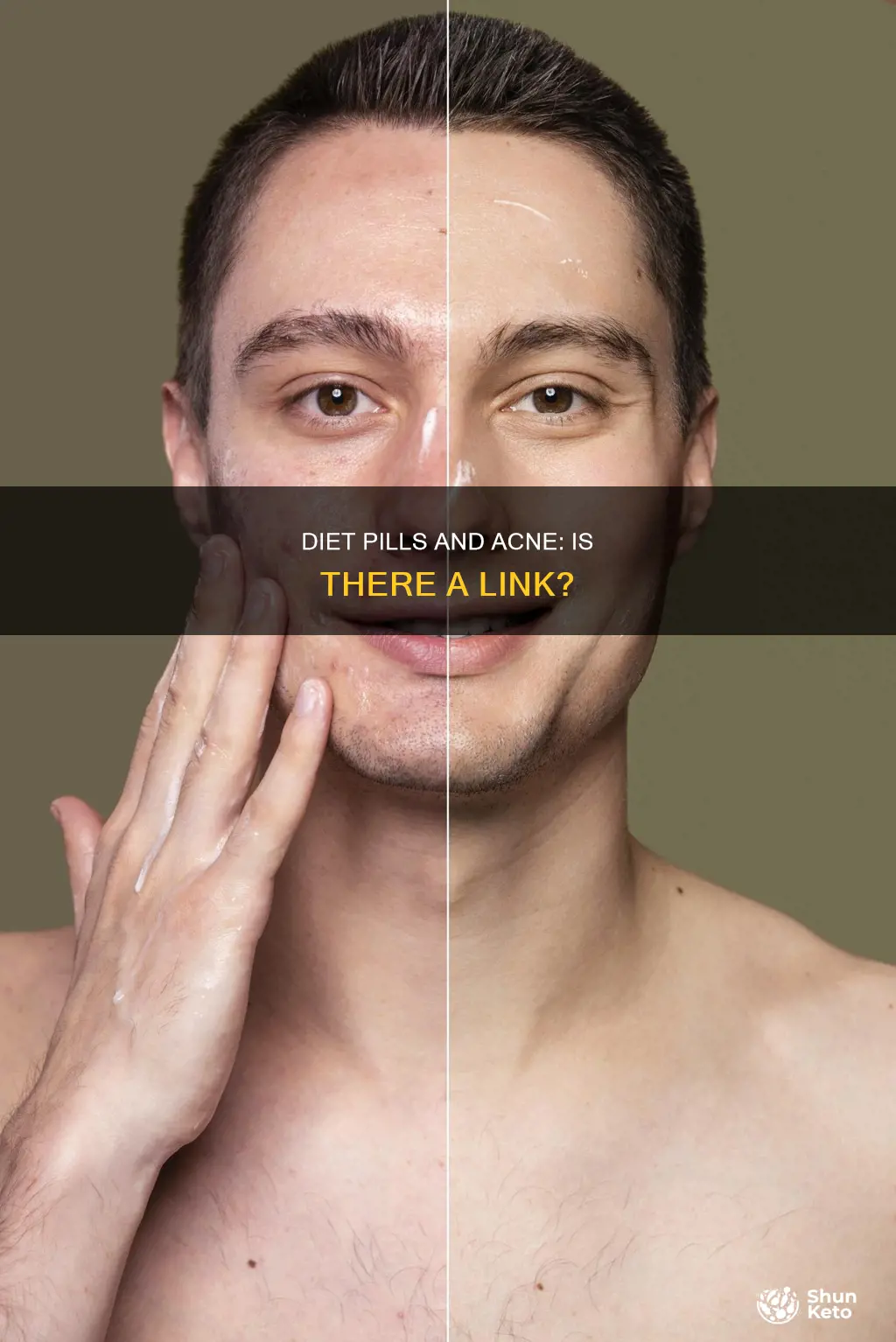do diet pills cause acne