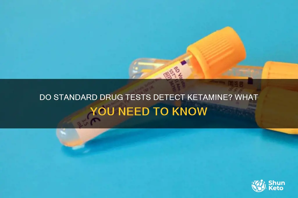 do drug tests test for ket