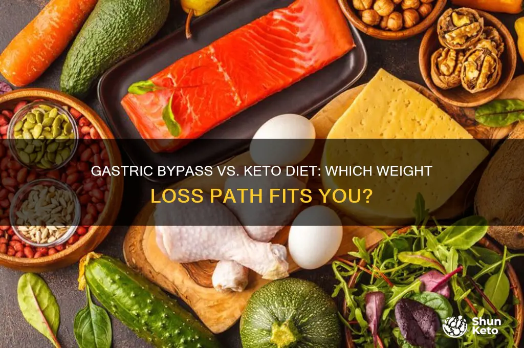 do i have gastric bypass or start the keto diet