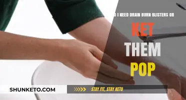 Should You Drain or Leave Burn Blisters to Pop? Expert Advice