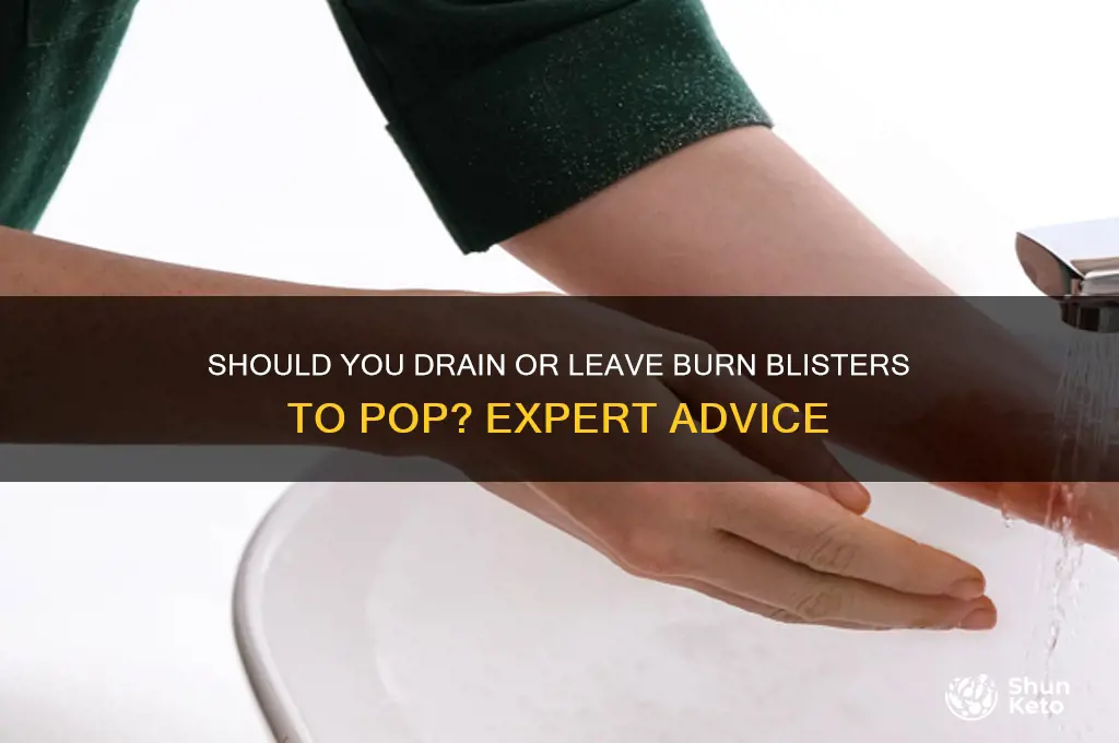 do i need drain burn blisters or ket them pop