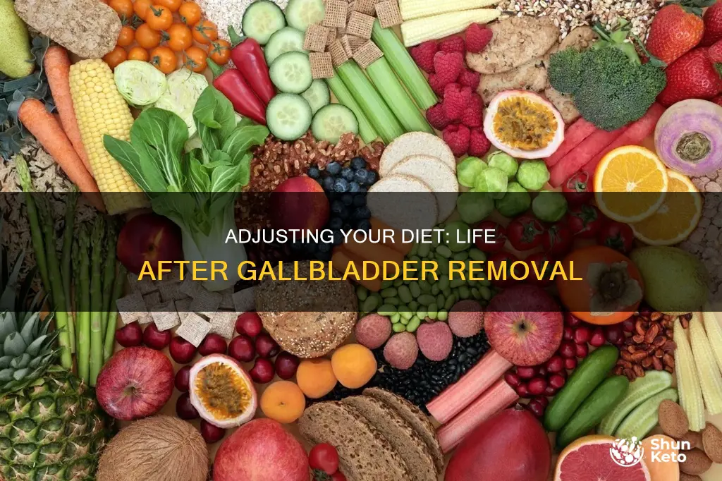 do i need to change my diet after gallb