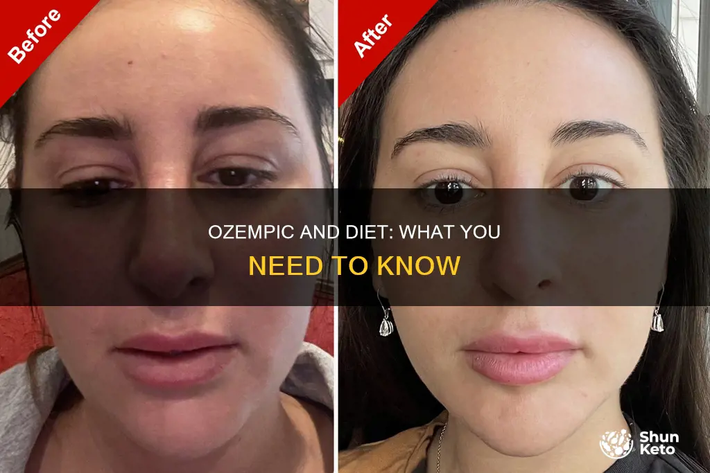 do i need to change my diet on ozempic