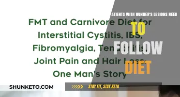 IC Patients: Dietary Restrictions for Hunner's Lesions?