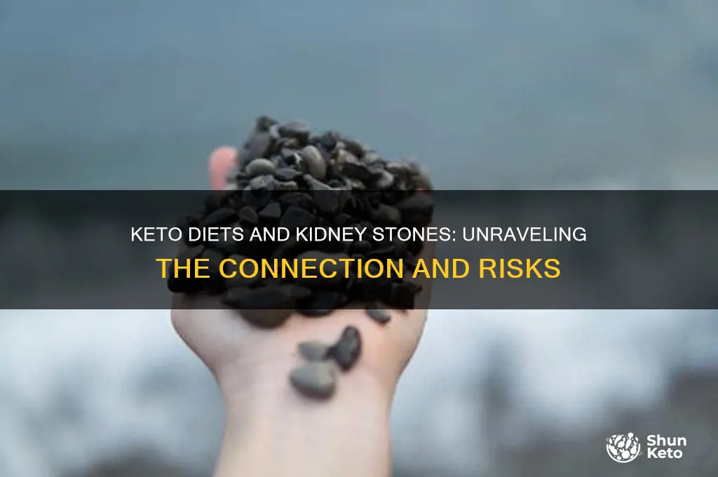 do keto diets cause kidney stones