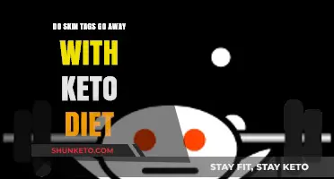 Can Keto Diet Help Remove Skin Tags Naturally?