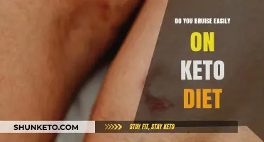 Does Keto Cause Easy Bruising? Understanding Diet and Skin Health