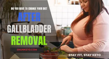 Adjusting Your Diet After Gallbladder Removal Surgery
