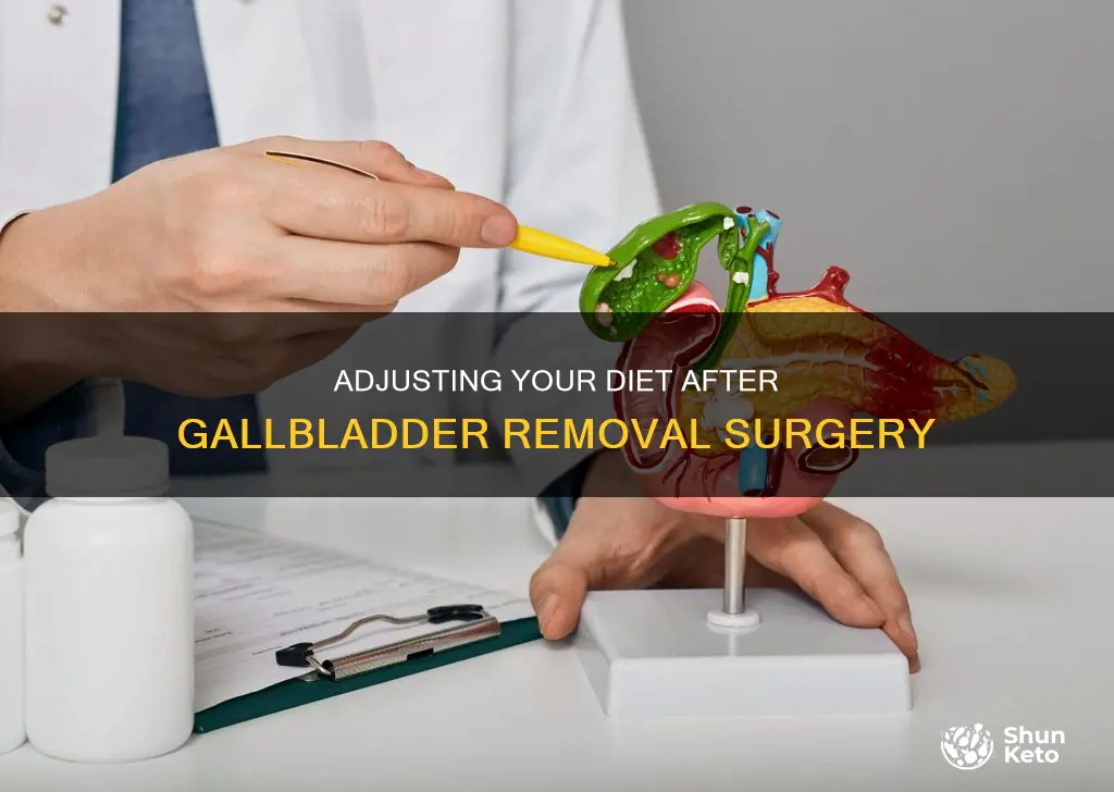 do you have to change your diet after gallbladder removal