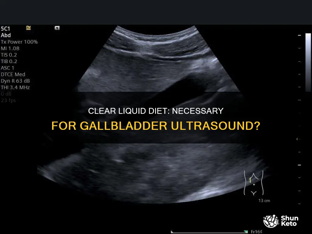 do you need a clear liquid diet for ultrasound gallbladder