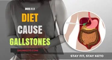 Dieting and Gallstones: Is the 5:2 Method Risky?