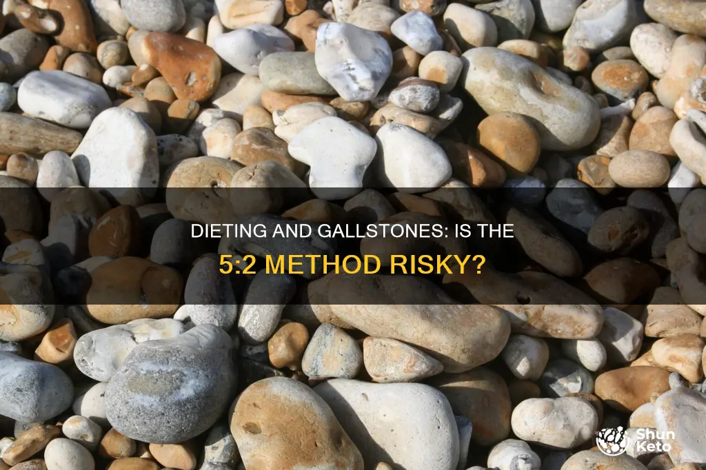 does 5 2 diet cause gallstones