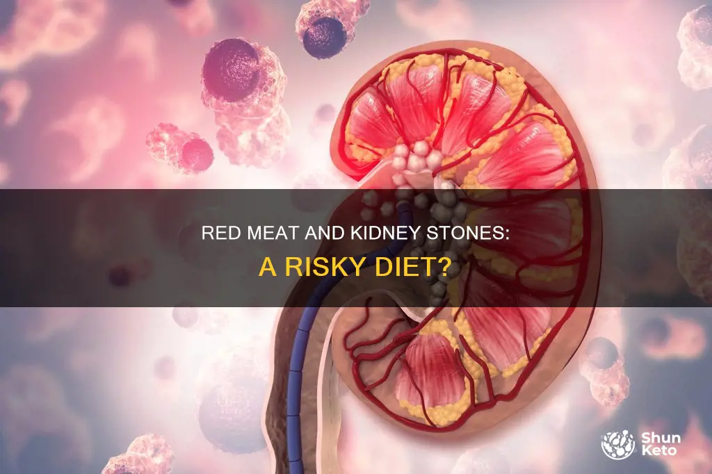does a diet rich in red meat cause kidney stones