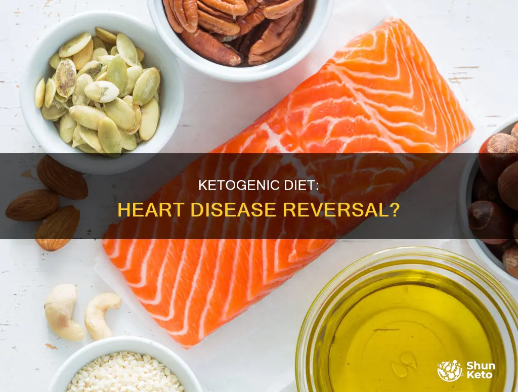 does a ketogenic diet reverse heart disease