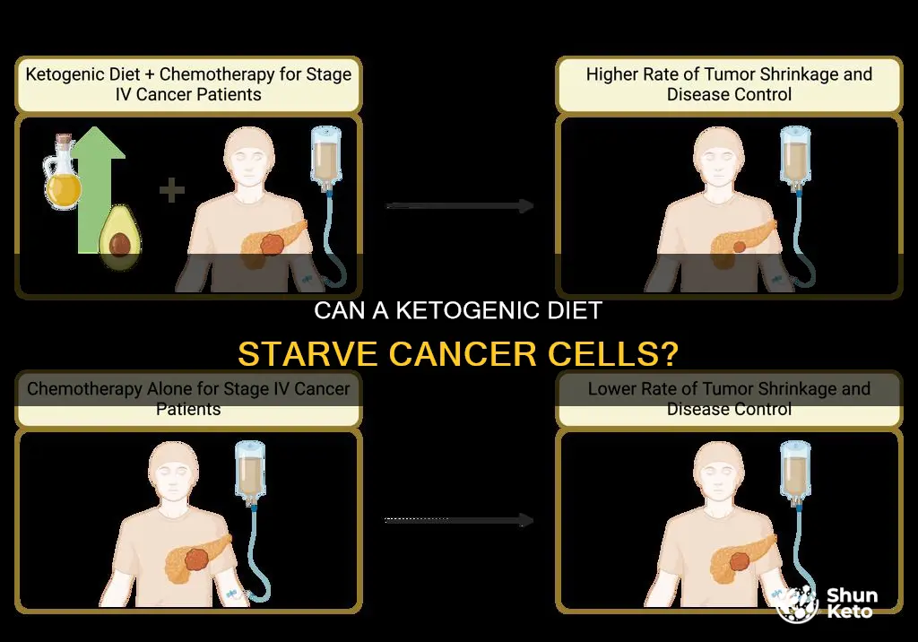 does a ketogenic diet starve cancer cells