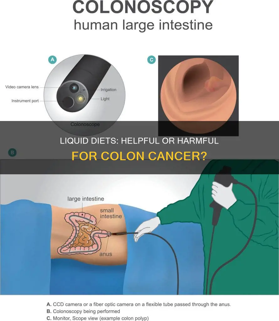 does a liquid diet help colon cancer