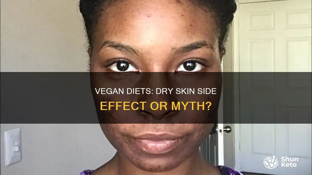 does a vegan diet cause dry skin