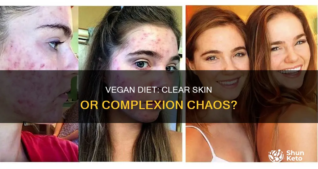 does a vegan diet clear skin