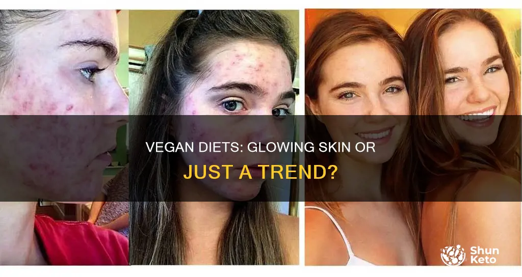 does a vegan diet improve your skin greatistgreatist