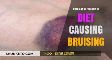 Deficiencies and Diet: Why Am I Bruising Easily?