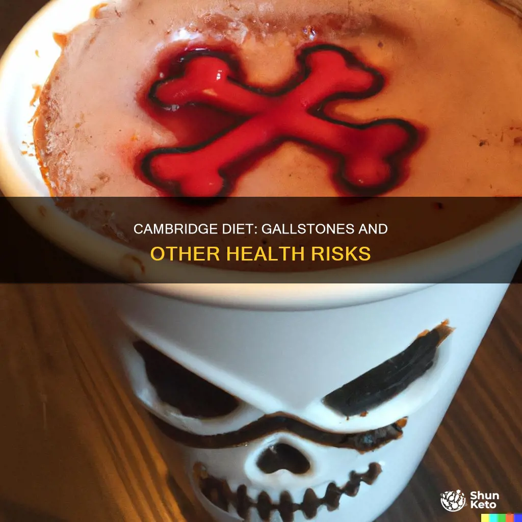 does cambridge diet cause gallstones