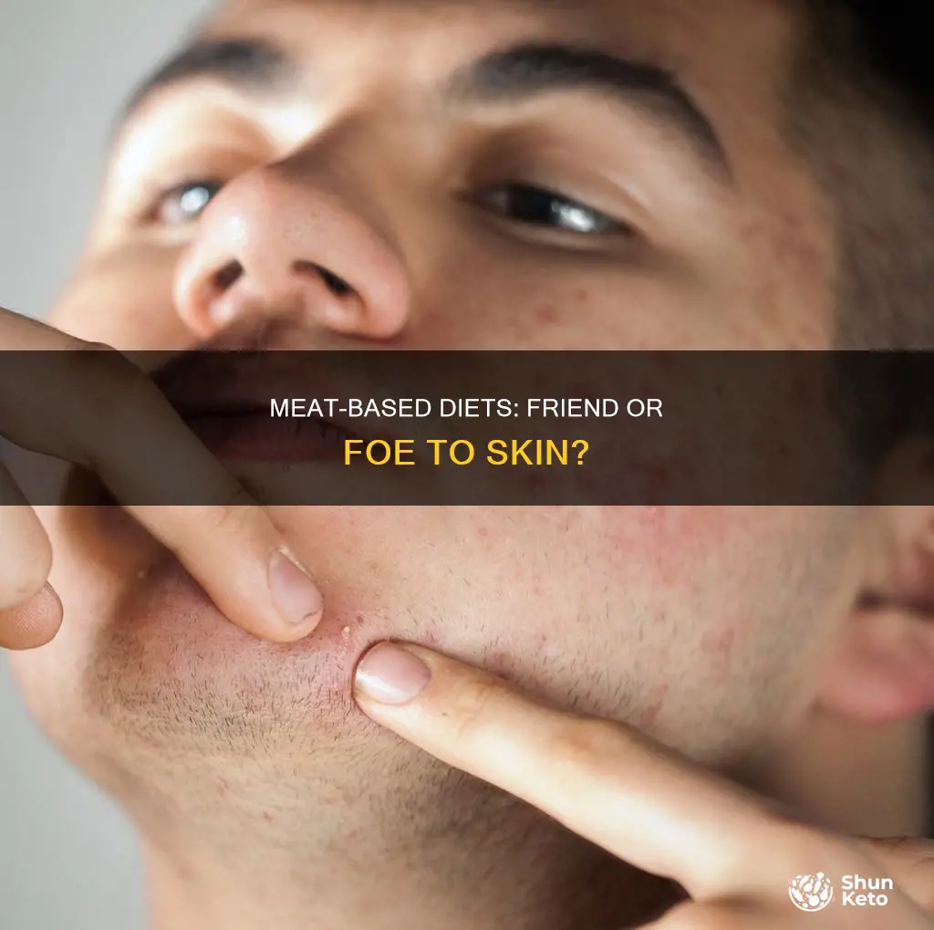 does carnivore diet cause acne