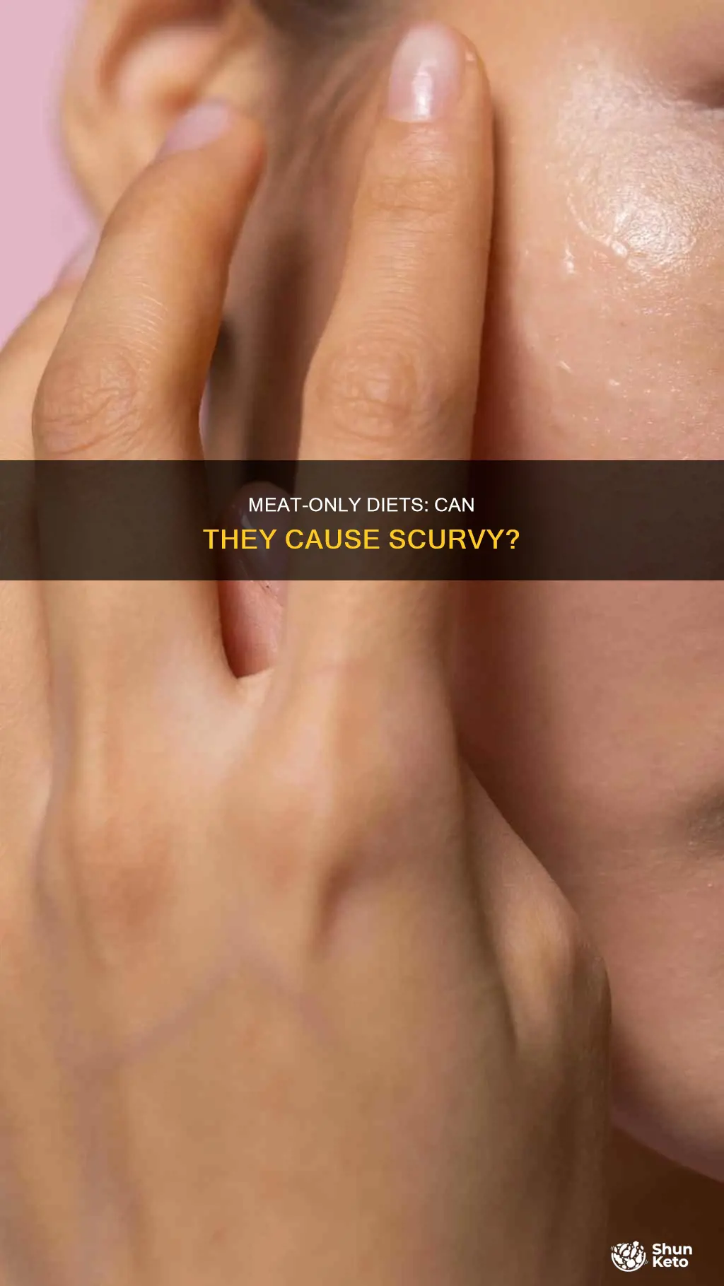 does carnivore diet cause scurvy