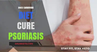 Carnivore Diet: Psoriasis Cure or Just a Fad?