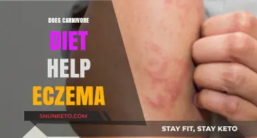 Carnivore Diet: An Eczema Cure or Just a Fad?