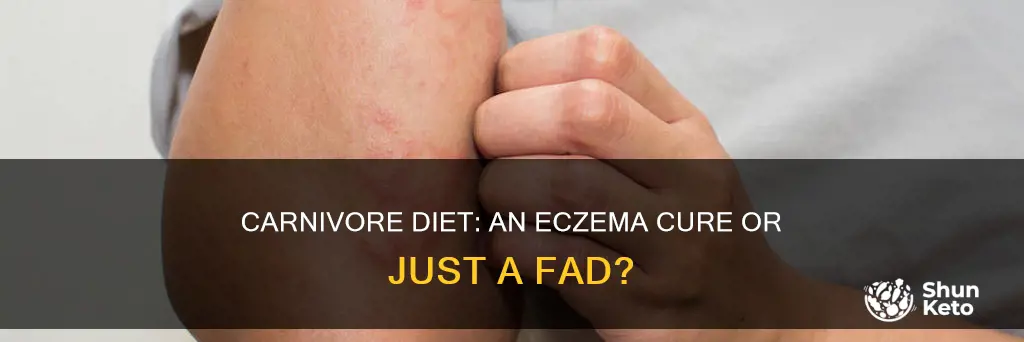 does carnivore diet help eczema