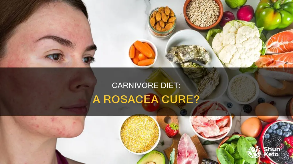 does carnivore diet help rosacea