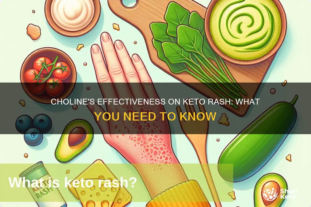 does choline work on keto rash